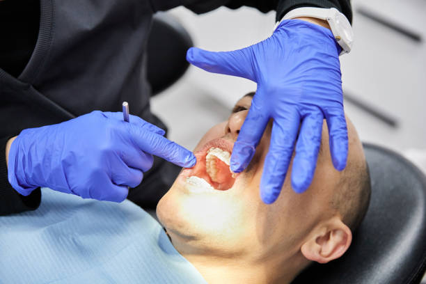 Best Emergency Dental Services for Seniors in San Marino, CA